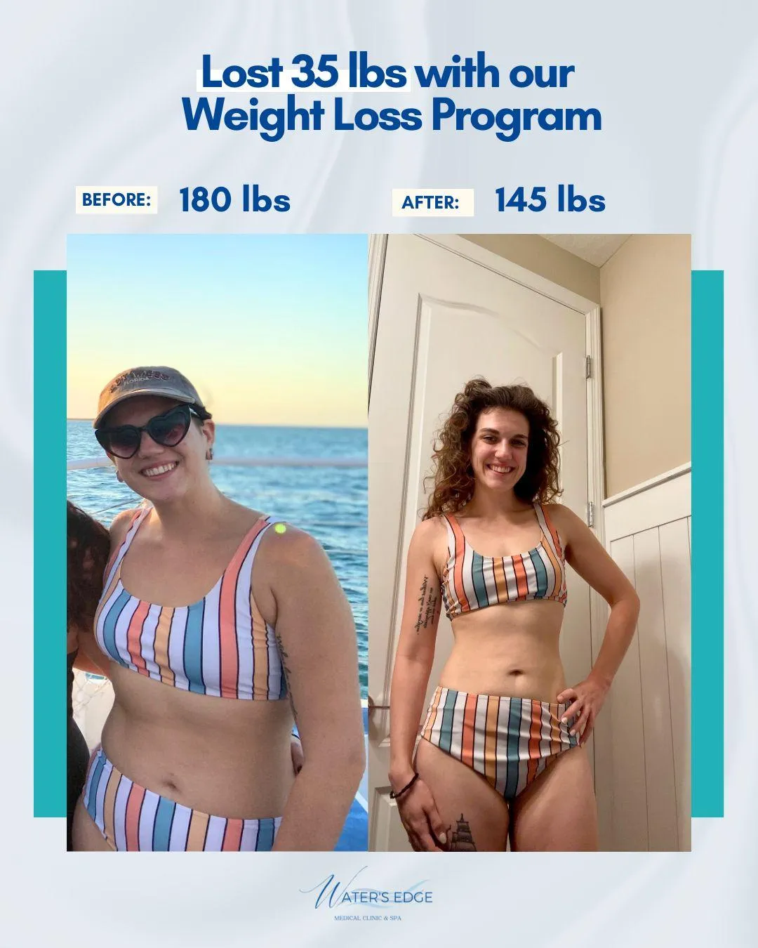 Patient lost 35 lbs with the Waters Edge weight loss program, before 180 lbs, after 145 lbs